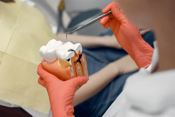Caries Removal