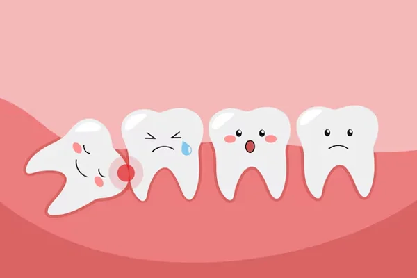 Impaction Surgeries